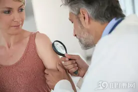 痒痒痒！脂溢性皮炎又称脂溢性湿疹，医生：做好5点或不复发图片