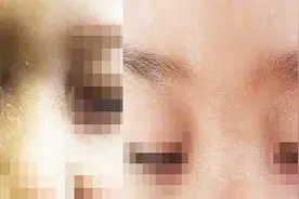 老师误开紫光灯 30余幼儿眼睛被灼伤 记者采访遭怼：你什么目的视频封面