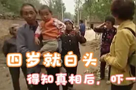 诡异“白头村”，男女老少都是白头，还患有肾结石，一调查吓坏了图片