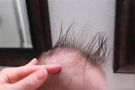 为啥新生儿有的头发，有的没头发？没头发的宝宝是发育晚吗？图片