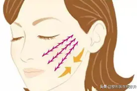 关于"面部线雕"，这是医生不会说的"真相"图片