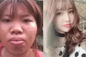 美女嫁入豪门后，因所生孩子过于丑陋被发现是花钱整容，结果如何图片