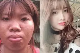 美女嫁入豪门后，因所生孩子过于丑陋被发现是花钱整容，结果如何图片