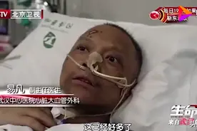 心疼！武汉两医生被救回后脸部全变黑，专家释疑图片
