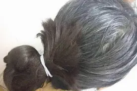 女性突然长出白发，是变老了吗？不一定，也可能是身体缺4种营养图片