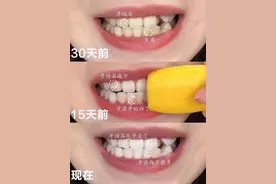 李佳琦的液体牙膏让我爱上刷牙！一口大黄牙变白，连呼气都是香的图片