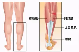 “小腿肌肉阻断术”冲上热搜，专家：该方法已经淘汰，切断神经不可修复图片