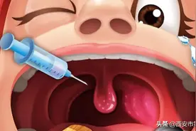 #我的健康十八式#   什么是扁桃体炎？图片
