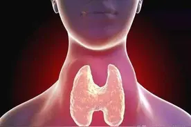 怎样区分甲状腺结节的良恶性？图片