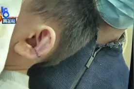 儿子走进“木马王国”小房间，出来耳朵割成两瓣，缝了三十针图片