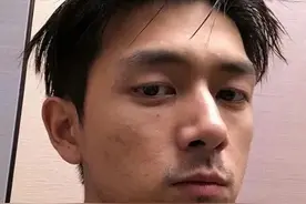 妆前妆后差距大！15位男星素颜曝光，皮肤坑坑洼洼，残留动脸痕迹图片