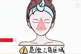 19岁女孩挤痘痘引发“颅内感染”，网友：要不…把我手剁了？图片