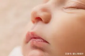 孩子嘴太干，还出了血，是水喝得少吗？医生的建议让家长明白真相图片