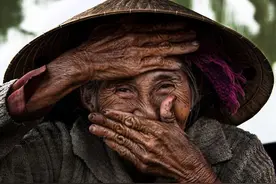 闫书禄整形医生医美拍摄技术分享图片