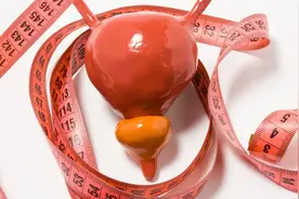 男性如何保护前列腺？做好这些事，可以延缓疾病的进展图片
