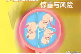 福祸相依的多胞胎，悲与喜就差那么一点点图片