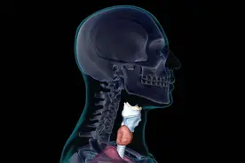 甲状腺癌猛增，是过度诊断引起？图片