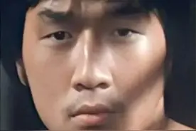 割双眼皮影响有多大？他们都是血淋淋的例子图片