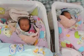 双胞胎姐妹情深，“手拉手”一起出生，有爱画面瞬间感动医生图片