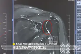 "肩周炎"被教科书除名！告诉爸妈“风火轮"别再做了图片