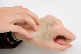 为什么有些人手上的青筋很粗？青筋粗，可能和什么有关？图片