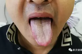案例分享｜中风前兆！脐灸如何调？图片