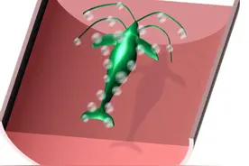 又是中国科学家！哈工大研发出能治癌症的机器人，动物实验已成功图片