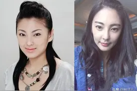 张雨绮、戚薇的双眼皮都是割的？明明单眼皮也能时髦个性又撩人啊图片