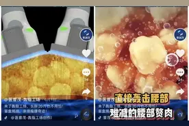 骗子比胖子还多？减肥行业的千层套路，你中过招吗？图片