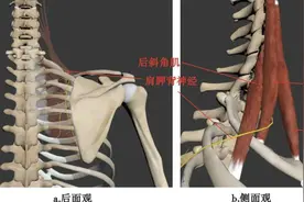 分享：一例“顽固性”肩胛缝疼痛治疗案例图片