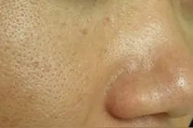 皮肤粗糙显老怎么办？平时多做这5件事，皮肤细腻有光泽图片