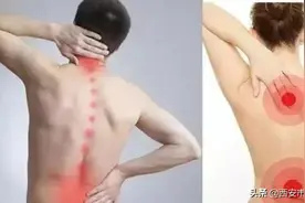 #健康科普汇#【肌筋膜炎的临床表现】图片
