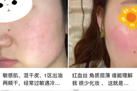 90%的皮肤问题是「作」出来的，快来看看你中招了没？图片
