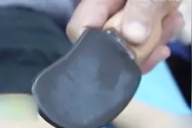 失传疗法重现江湖，破石头能治乳腺病？中医专家告诉您其中奥秘？视频封面