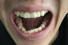 如何正确辨别正畸医生，避免前期走错弯路图片