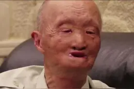 "活着的邱少云"—涂伯毅：被美军汽油弹毁掉容颜，上街吓哭小孩图片
