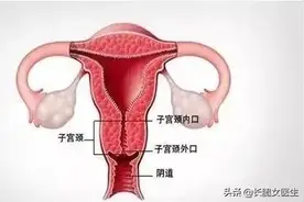 青年女性子宫的正常解剖及MRI影像解剖图片