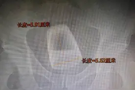 医生在直肠里找到了啤酒杯、罗非鱼、茄子、灯泡、泥鳅图片