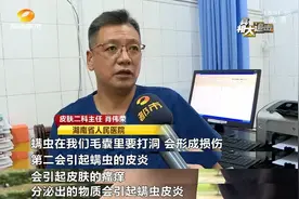 一床被子百万螨虫？除螨仪、超声波除螨器、除螨包效果到底如何 医生告诉你最好的除螨办法图片