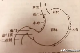 胃癌全胃切除对人寿命的影响图片