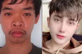 越南男子壕掷4亿整容，帅到亲妈都认不出，网友：这是换了个头吗图片