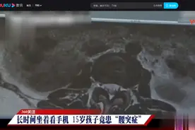 15岁少年椎间盘突出，年轻人腰椎如此脆弱，到底因何而起图片