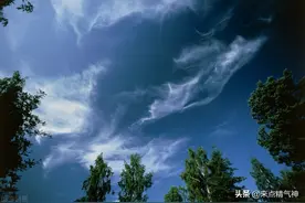 气郁体质者应多按摩支沟穴，它是治疗气的天然药库！脉是如琴弦图片