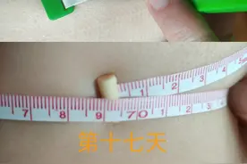 酮饮食减肥第十七天，不运动，不挨饿，腰围从72.5变为69厘米图片