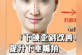 下颌歪斜、嘴角不对称改善，同时提升下垂的嘴角「内附矫正视频」图片