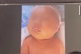 出生17天宝宝患重病进ICU，妈妈称被月嫂传染！母婴馆：没证据图片
