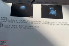 女子连续20天夜夜将小龙虾当夜宵，导致「孕妇杀手」找上门...图片