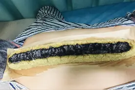 你怕冷吗？老中医教你一招，所有“寒性”疾病都有效图片
