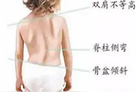 家长这样抱孩子，当心娃以后驼背、高低肩，图解4种正确抱娃姿势图片