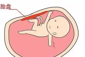 生完孩子后，胎盘是带回家还是留医院？听听这最科学的处理办法图片
